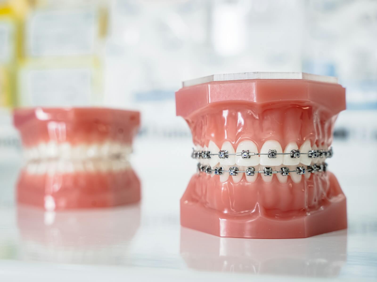 A close up of a tooth with braces on it