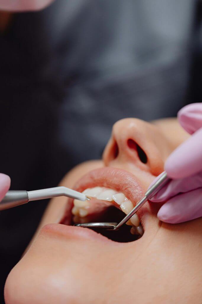 checking teeth at orthodontist