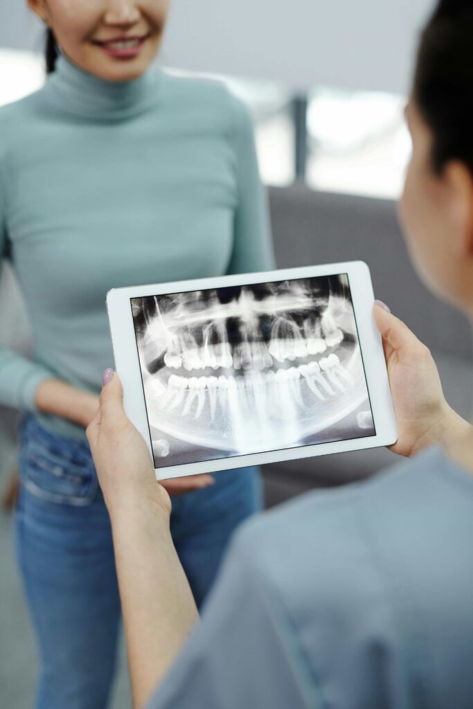 x ray of crossbite